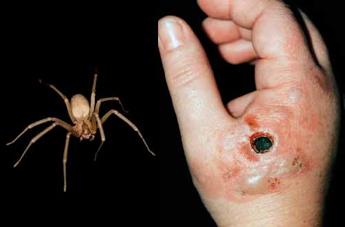 Araña violinista slp